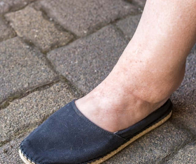 What to take to combat fluid retention? 