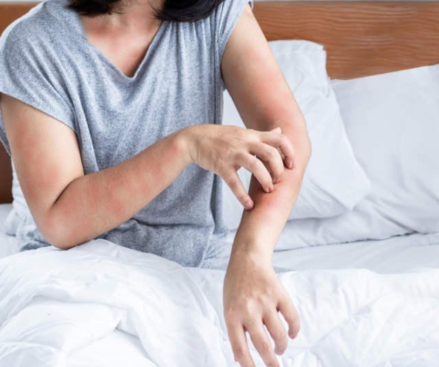 How to eliminate mites from home? 