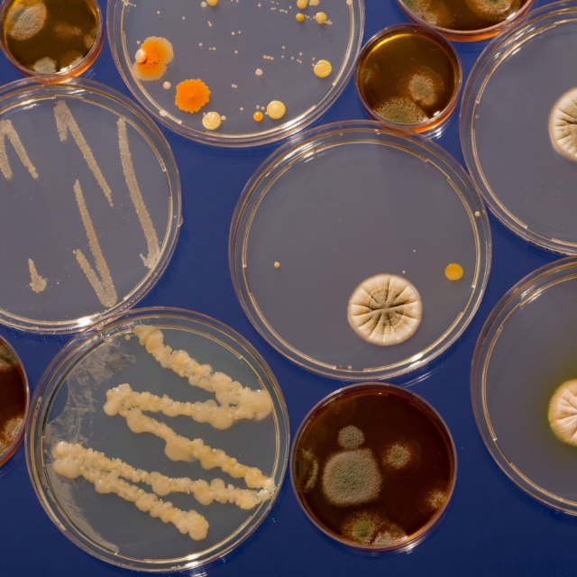 La importancia de los Microorganismos